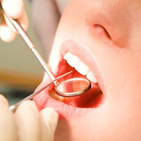 Teaser Leistungen Parodontologie