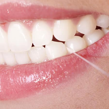 Teaser Leistungen Prophylaxe