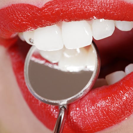 Teaser Leistungen Zahnästhetik